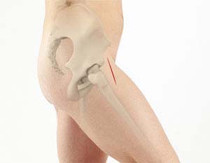 Direct Anterior Hip Replacement