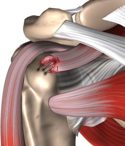 Shoulder