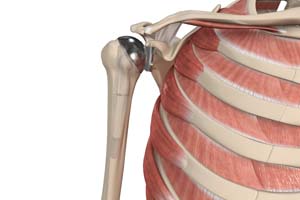 Shoulder